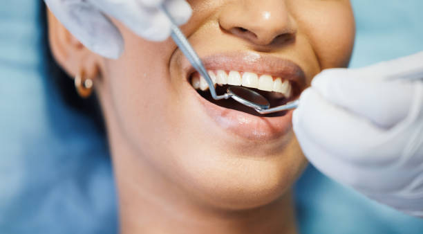 Best Weekend Emergency Dentist in Lincoln Village, CA